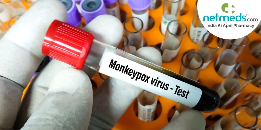 Monkeypox virus - Test