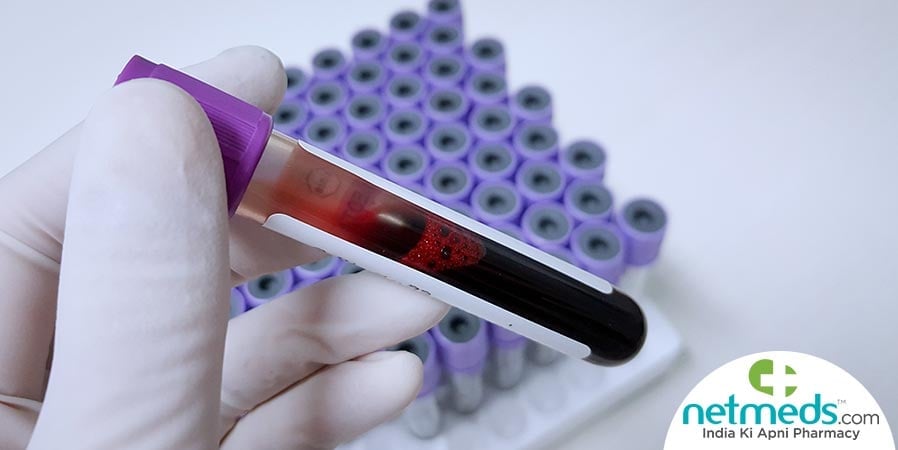 Blood culture test