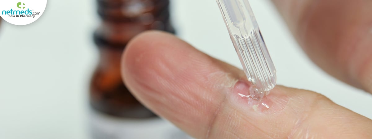 salicylic acid 2