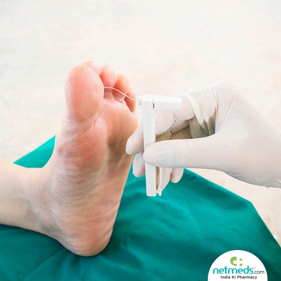 Doctor Checking For Diabetic Neuropathy