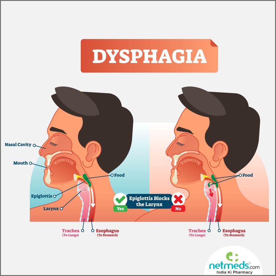dysphagia difficulty in swallowing