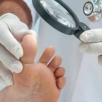 Stinky feet? Could Be Foot Fungal Infection