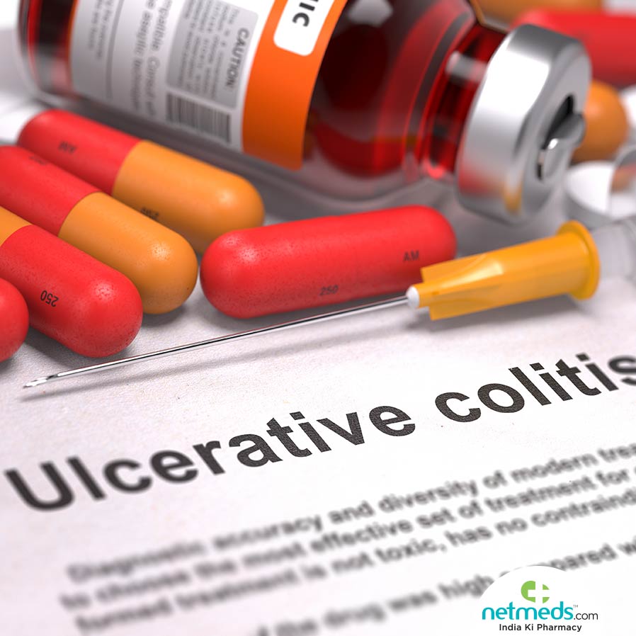 ulcerative colitis