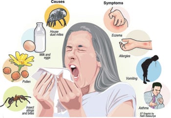 Girl sneezing and allergies