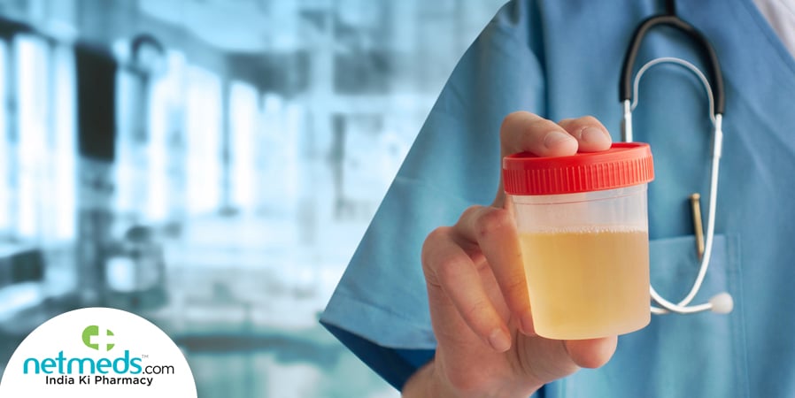 foamy urine