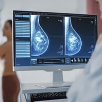 Papillary Breast Cancer: Causes, Symptoms And Treatment