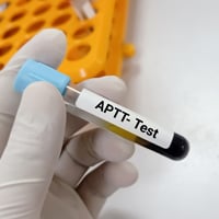 Activated Partial Thromboplastin Time (APTT) Test: What Is It And What To Expect?