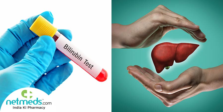 Bilirubin test