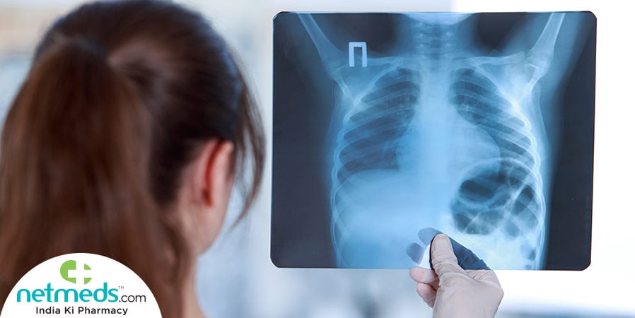 Doctor looking at the x-ray