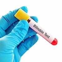 Bilirubin Test: Why It Is Done And What To Expect
