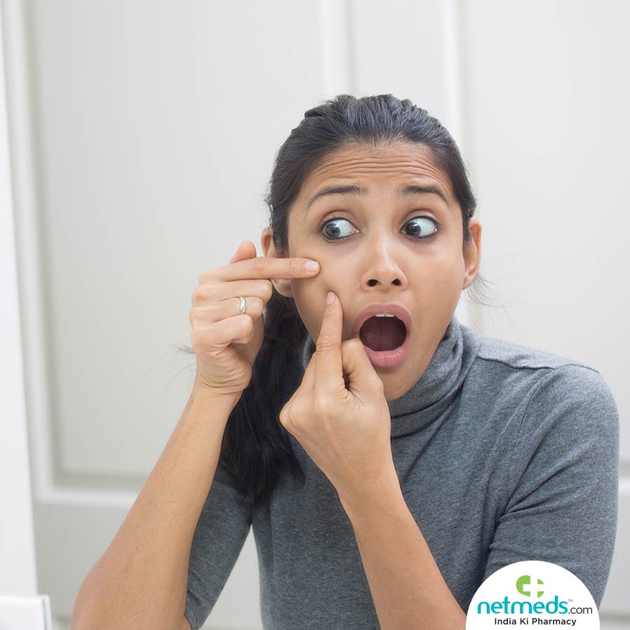 Pimples In Teenagers