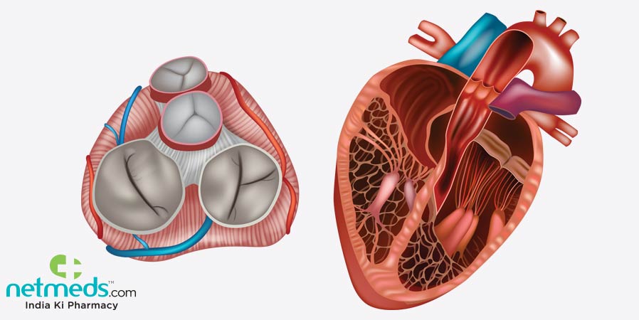 Pulmonary Valve Stenosis