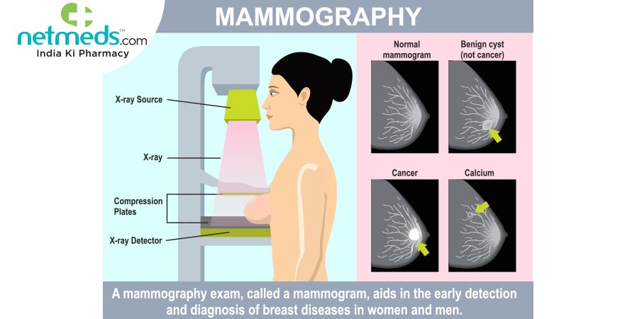 Mammography