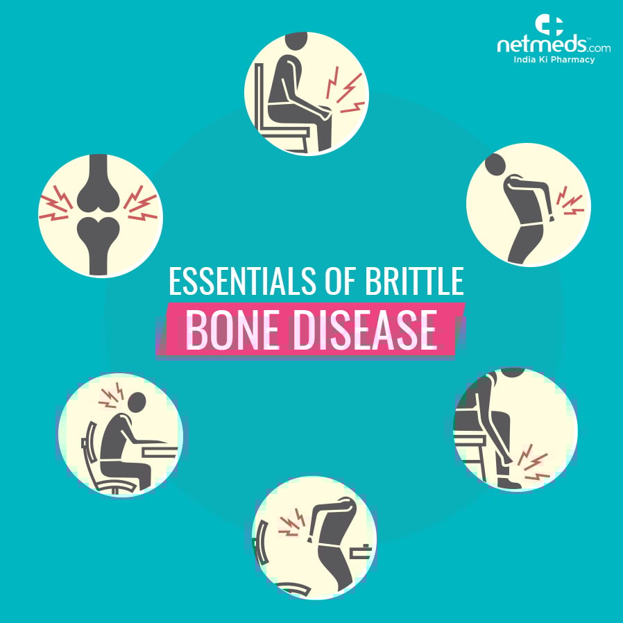 How Does Osteogenesis Imperfecta Affect The Body?