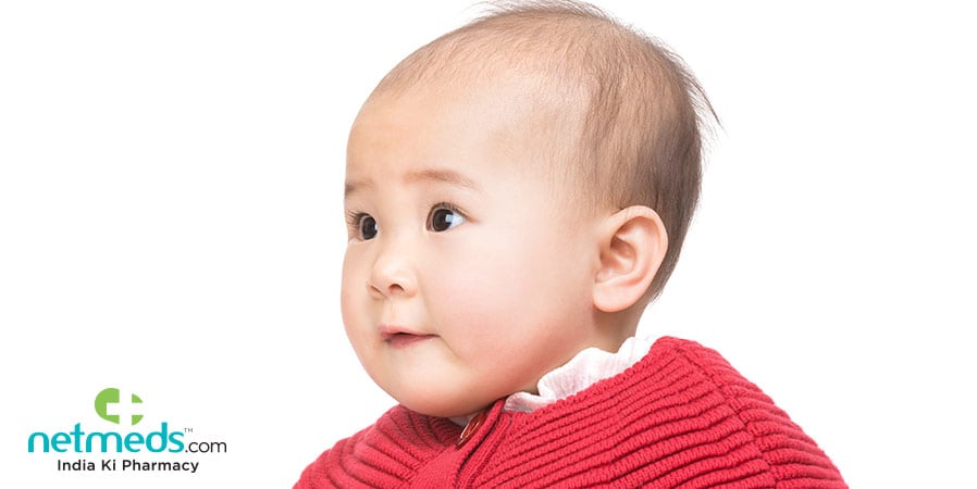 Child With Loose Anagen Syndrome