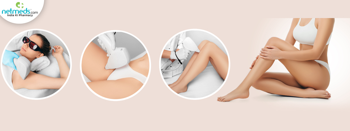 epilation 
