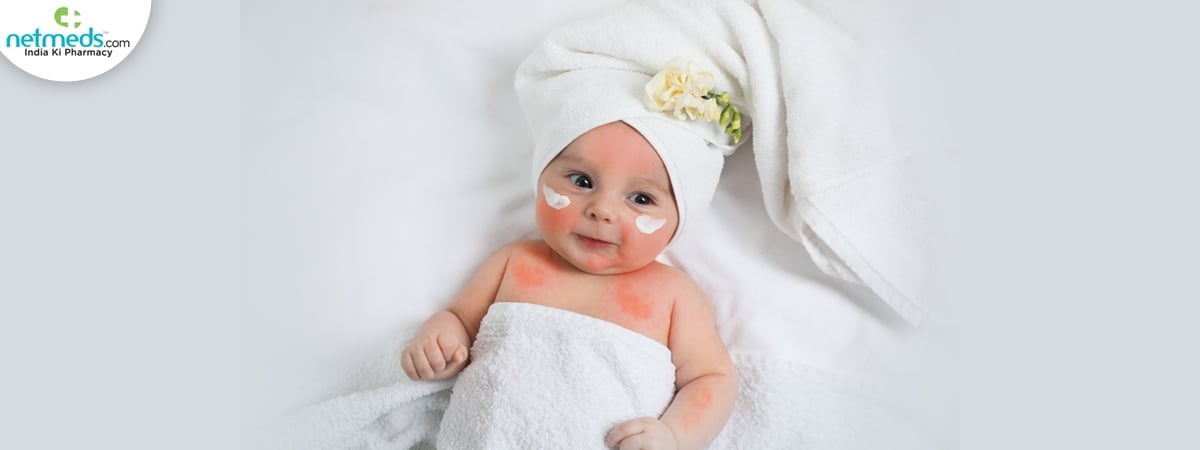 baby skin rash