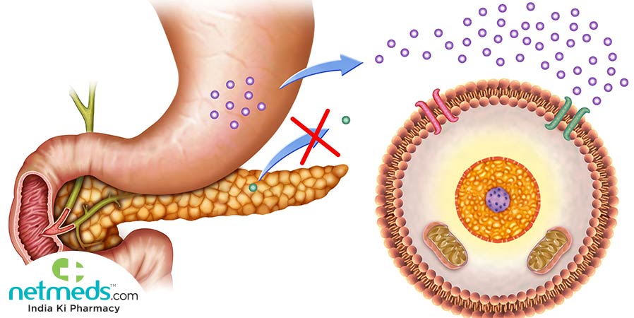 Exocrine pancreas insufficiency