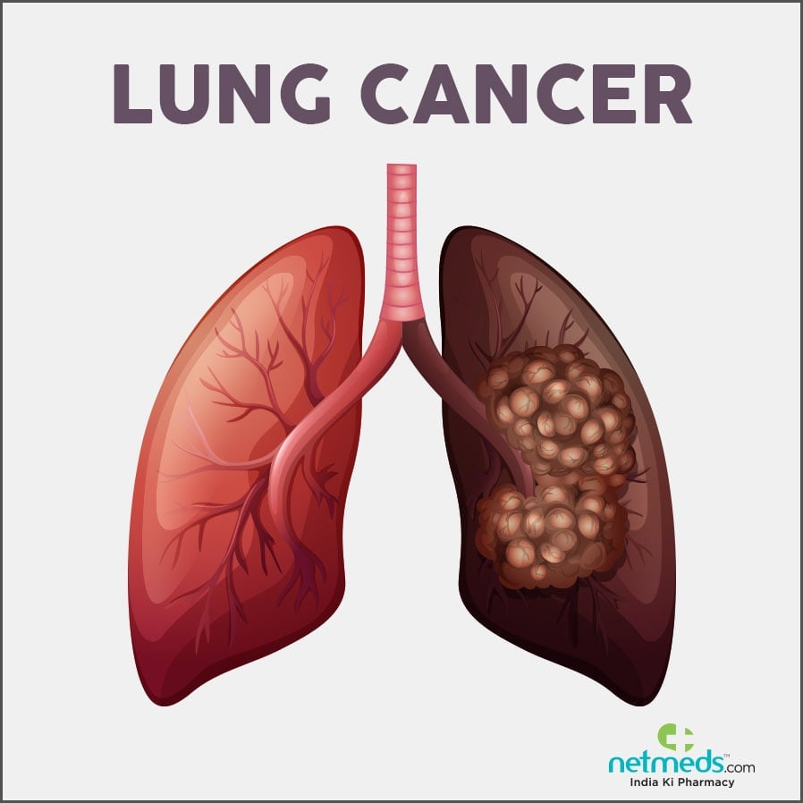 lung cancer causes and symptoms