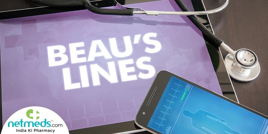 Beau's Lines