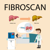 FibroScan: What Is It And What To Expect?