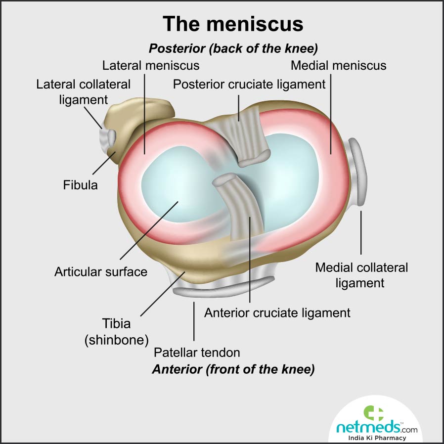 torn meniscus