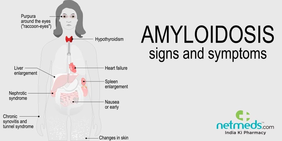 Amyloidosis