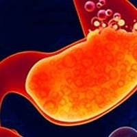 Acidity: Signs, Symptoms And Prevention 