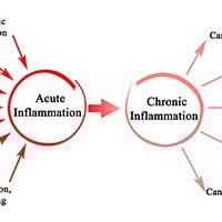 Inflammation: Types, Causes, Symptoms And Treatment