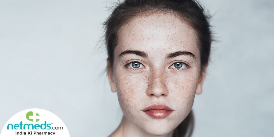 Girl with freckles