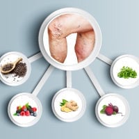 Varicose Veins: Must -To Add Power Foods For Better Circulation And Vein Health-Infographic