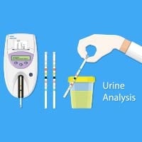 Urinalysis: What Is It And What To Expect?