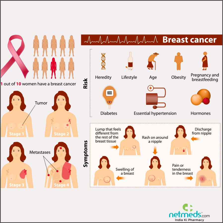 breast cancer causes
