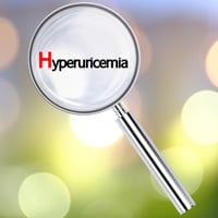 Hyperuricemia: Symptoms, Causes, Diagnosis And Treatment