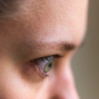 Grave’s Ophthalmology/Thyroid Eye Disease: Causes, Symptoms And Treatment