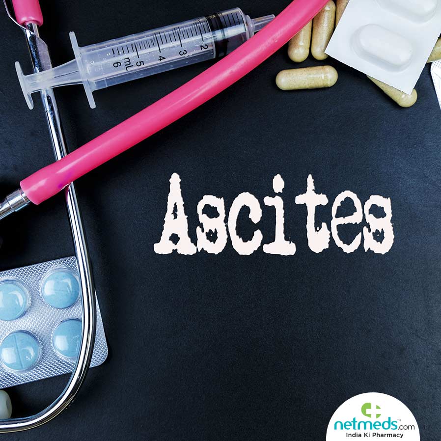 Ascites :Causes and treatment 
