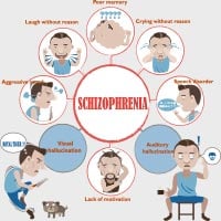 Schizophrenia: Causes, Symptoms And Treatment