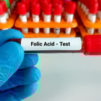 Folic Acid Serum Test: What It Is, Purpose, Procedure And Results