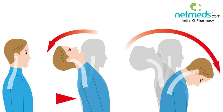 Whiplash illustration