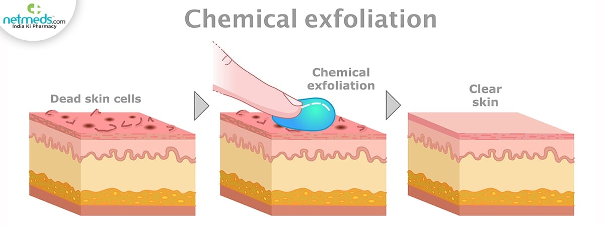 chemical exfoliation benefits