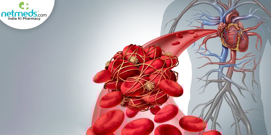 Blood clots