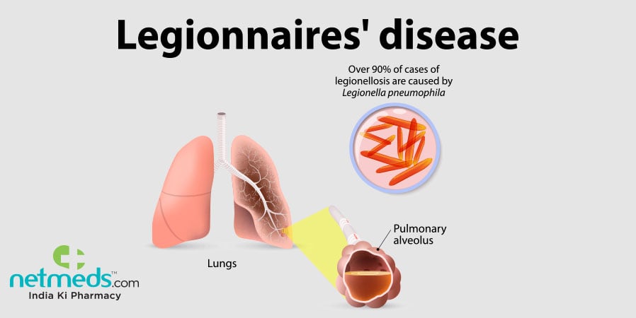 legionnaire's disease
