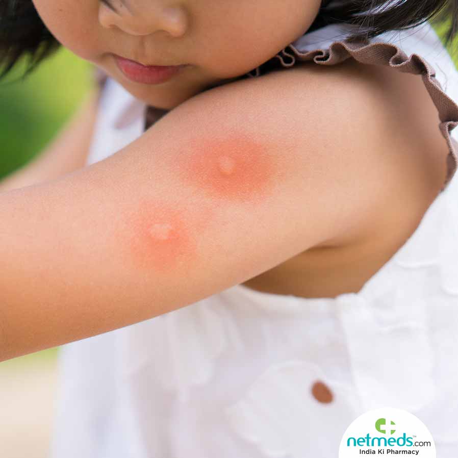 Don’t Ignore Fever