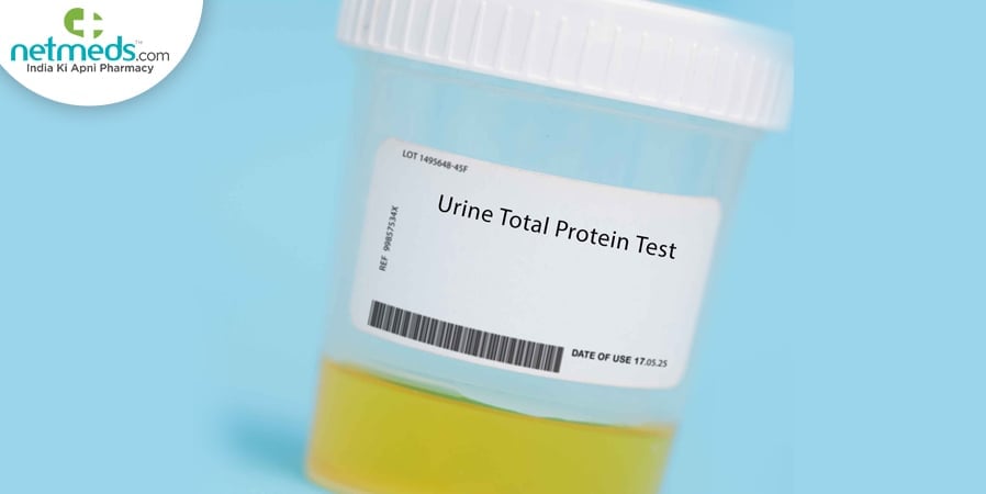 urine test
