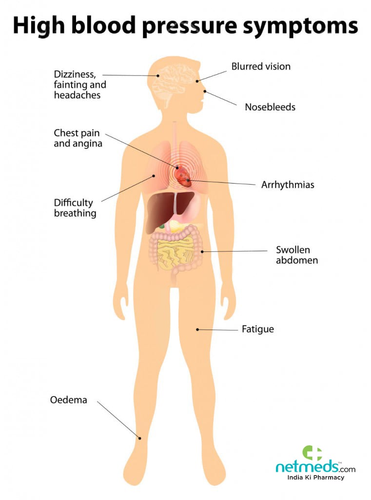 high blood pressure symptoms