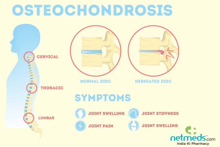 osteochondrosis