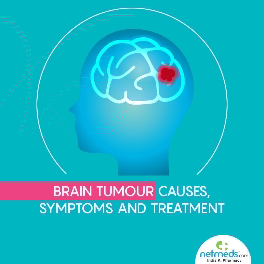 Brain tumor causes