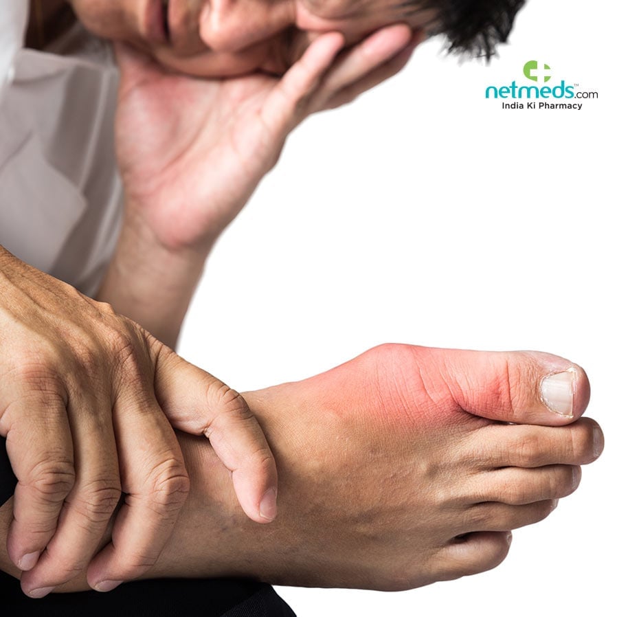 Febuxostat: Treating Gout Effectively