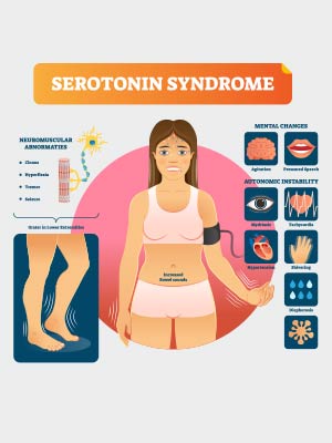 सेरोटोनिन सिंड्रोम: कारण, लक्षण, निदान और उपचार