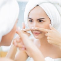 Blackheads: 3 Amazing Sheet Masks To Remove Those Pesky Dark Spots Naturally